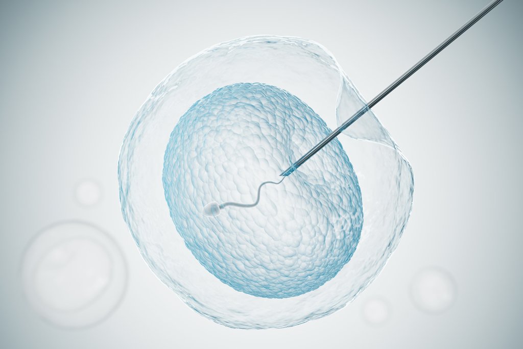 Este procedimiento no solo mejora las posibilidades de fecundación en parejas con factores masculinos severos, sino que también se utiliza en otros contextos para garantizar un resultado exitoso, incluso cuando no existe un diagnóstico masculino grave.