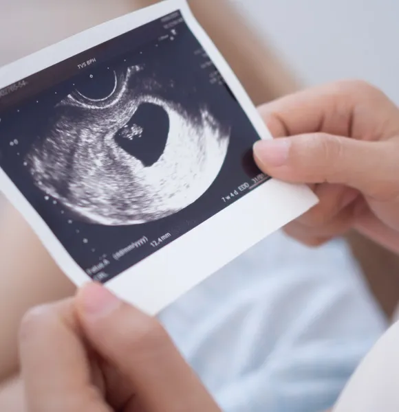 Tratamientos de Alta Complejidad - Fecundación in vitro (FIV-ICSI) - Clínica CER